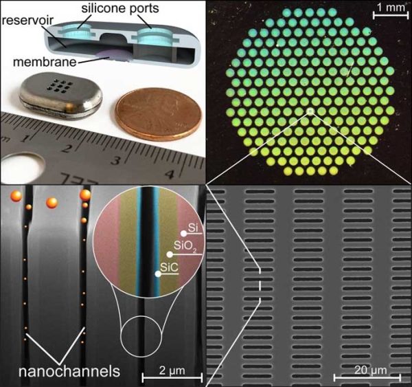 4 images describing nanofluidic implants