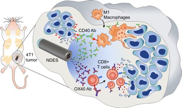 diagram of intratumoral drug delivery